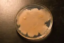 fungus growing in petri dish