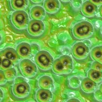 plant cells under microscope
