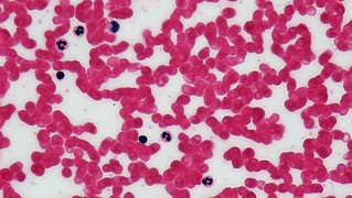 By Berkshire Community College Bioscience Image Library, Public Domain.  Connective Tissue: Human Blood Leukocyte Survey  smear; human blood magnification: 400x hematoxylin eosin stain