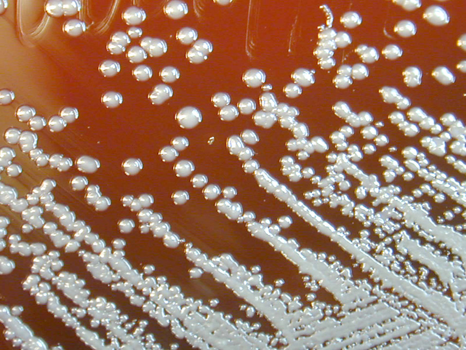 Burkholderia pseudomallei grown on sheep blood agar for 48 hours. Creator:CDC/ Courtesy of Larry Stauffer, Oregon State Public Health Laboratory