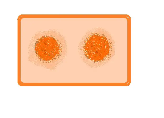 Diagrammatic representation of a cell during telophase (late telophase), Onion root tip mitosis. Credit: MicroscopeMaster.com