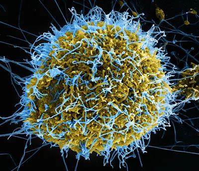 Colorized SEM of filamentous Ebola virus particles (blue) budding from a VERO E6 cell (yellow-green). https://creativecommons.org/licenses/by/2.0/ image unaltered by NIAID on Flickr.com.
