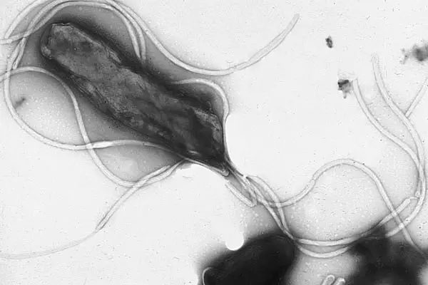 Electron micrograph of H. pylori possessing multiple flagella (negative staining). Epsilonproteobacteria. Yutaka Tsutsumi, M.D.ProfessorDepartment of PathologyFujita Health University School of Medicine, via Wikimedia Commons