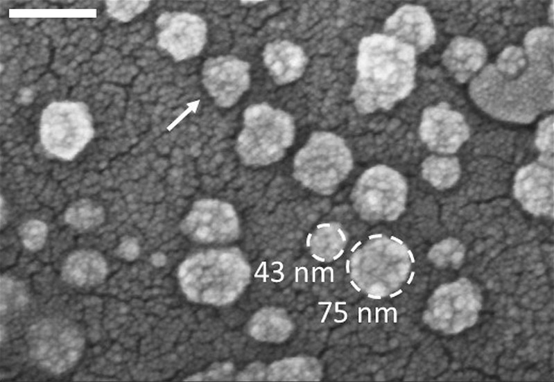 Exosomes samples  - Electron micrograph of exosomes on a surface. Credit: IBM Research.