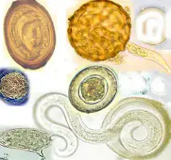 A helmintfertőzéseket a - A leghatékonyabb megoldás a pinworms eltávolítására - Mutassa pinworms