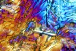 microscopic artificial sweetener crystals in polarized light