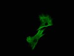 immunohistochemical stain of vimentin protein in smooth muscle cells - confocal laser microscope