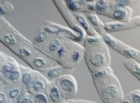 https://www.microscopemaster.com/images/iStock_000015098022XSmallDICimageofonioncells.jpg