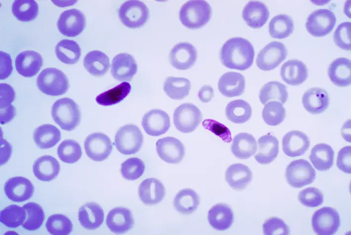 Malaria Infection By Photo Credit: Content Providers(s): CDC/Dr. Mae Melvin Transwiki approved by: w:en:User:Dmcdevit [Public domain], via Wikimedia Commons