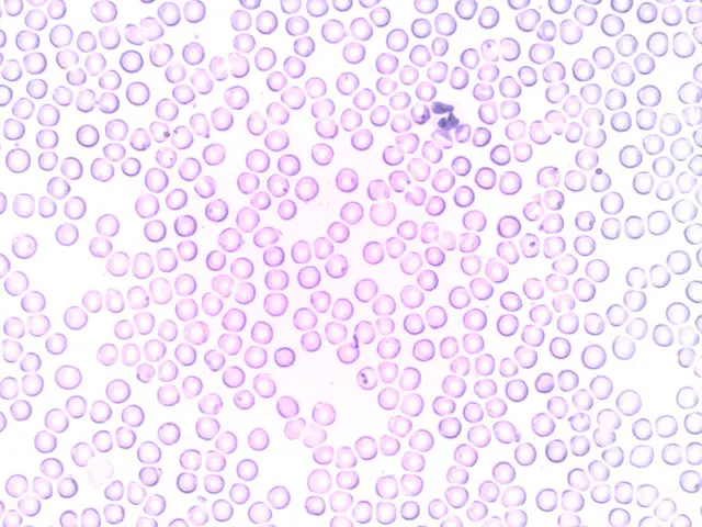 Granulocyte: Neutrophil and Segmented Neutrophil