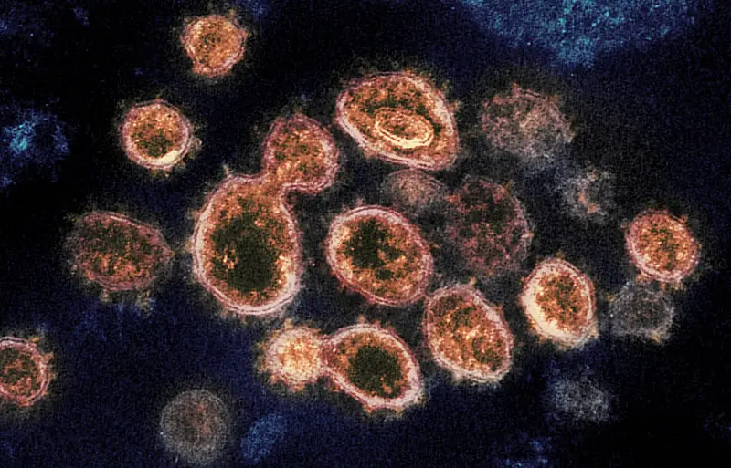 by NIH Image Gallery  Novel Coronavirus SARS-CoV-2  This transmission electron microscope image shows SARS-CoV-2, the virus that causes COVID-19. Flickr, public domain, unaltered.