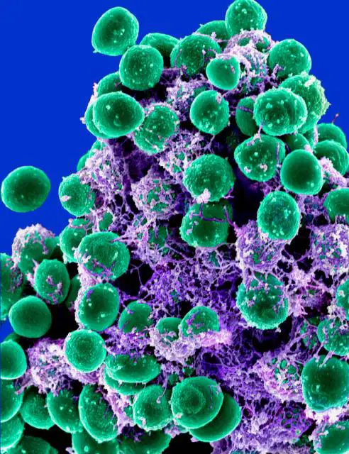 Staphylococcus epidermidis Bacteria - SEM of Staphylococcus epidermidis (green) in extracellular matrix connecting cells and tissue. Credit: NIAID, https://creativecommons.org/licenses/by/2.0/