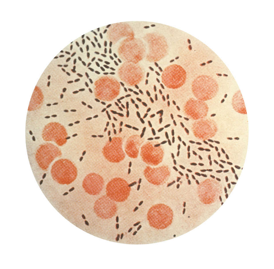 Photomicrograph of Streptococcus (Diplococcus) pneumoniae bacteria using Gram stain technique. Creator: CDC, Public Health Image Library